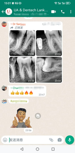 Bán buôn kỹ thuật số nha khoa <span class=keywords><strong>X</strong></span>-<span class=keywords><strong>Ray</strong></span> máy toàn cảnh Hệ thống hình ảnh thú y chẩn đoán thiết bị - Product Image 5