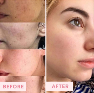 Bio mặt Masque Visage Soin cho africain COTA tối thiểu raffermissant ET rajeunissent mặt tissu Masque - Product Image 4