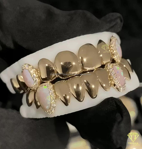 Grillz personnalisés faits à la main en opale, moissanite et diamant, en argent 925, bijoux dentaires sertis de pierres, livraison rapide - Product Image 5