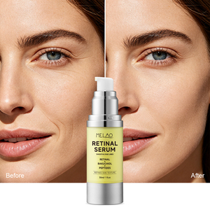 Ensemble d'essences raffermissantes aux peptides, réparation des rides, hydratation, soin de la texture, élasticité, produits de beauté, sérum GHK-Cu - Product Image 4