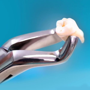 Forceps d'extraction dentaire en acier inoxydable, instruments chirurgicaux dentaires professionnels, outils d'extraction dentaire, chirurgie buccale - Product Image 2