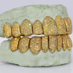 Iced Out Hip Hop rapero Grillz con personalización de calidad superior joyería Dental decoración de dientes personalizar Color amarillo Grillz - Product Image 1