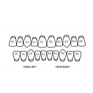 Grillz dentaire Hip Hop en argent 925 plaqué or rose personnalisé avec moissanite, motif nid d'abeille, certifié par un tiers, pour hommes et femmes - Product Image 5