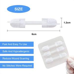 Tıbbi Zip dikiş cilt germe ve güvenli yara kapatma şerit yara kapatma cihazı fermuar - Product Image 6