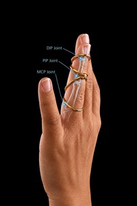 Arthritis Finger Splint Bending Sideways Lateral Deviation Silver/<b>Gold</b> Plated Brass <b>Ring</b> Women Minimalist Wholesale - Product Image 5