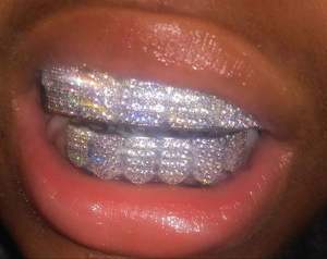 Grillz dentaire de luxe en argent 925 avec diamants Moissanite VVS de haute qualité, style Hip Hop, disponible à prix de gros - Product Image 2