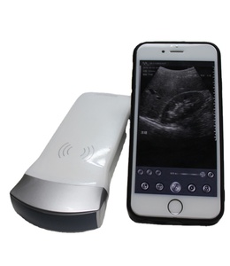 Sans fil android/ios réseau convexe usb sonde à ultrasons scanner à ultrasons ultrasons <span class=keywords><strong>de</strong></span> <span class=keywords><strong>poche</strong></span> à <span class=keywords><strong>prix</strong></span> <span class=keywords><strong>de</strong></span> vente - Product Image 1