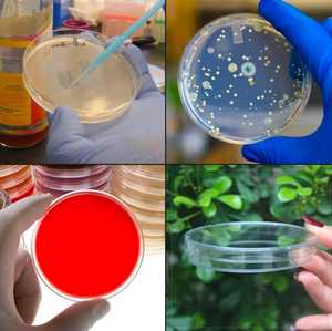 Sterile Disposable Plastic <b>Petri</b> <b>Dishes</b> 90x15mm with 2 Rooms 60mm 35mm 150mm Sizes - Product Image 6