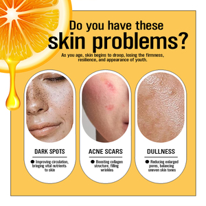 Crème Visage Éclaircissante Mestin Private Label Vitamine C Acide Hyaluronique Hydratation Récupération Après-<span class=keywords><strong>Soleil</strong></span> Nuit Anti-Âge Éclat 50ml - Product Image 3