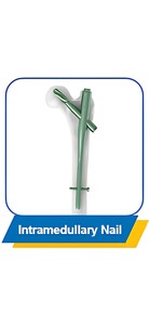 Implante de Reemplazo de Cadera, Cabeza Femoral Artificial y Prótesis de Vástago - Product Image 6