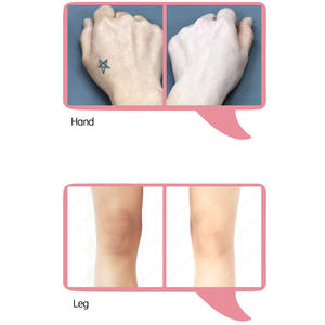 Crema Facial y Corporal con Niacinamida para el Cuidado de la Piel con Melasma, Crema Coreana para el Cuidado de la Piel, Tónico, Suero, Cosméticos Faciales, 20 kg - Product Image 4