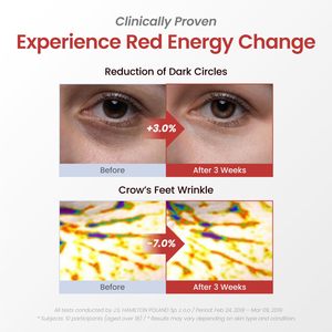 แผ่นมาส์กใต้ตา YADAH Red Eye Patch 60 คู่ แผ่นไฮโดรเจลใต้ตาผสมทับทิมและโสมเพื่อความชุ่มชื้น ลดอาการบวม - Product Image 3