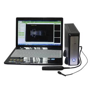 Escáner Oftálmico de Ultrasonido AB de Alta Calidad, Escáner de Ojos, Máquina Oftálmica, Sistema de Diagnóstico Oftálmico AB Scan - Product Image 1
