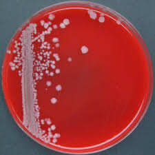 Bacterias Lácticas Probióticas Bacillus Coagulans de la Marca IGC de Maharashtra - Product Image 3