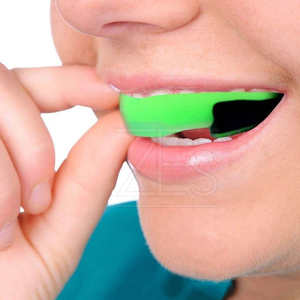 Protège-dents et protège-lèvres de sport de haute qualité, dernier design, personnalisable, pour adultes, unisexe, football, volley-ball, couleurs personnalisées, pour activités sportives en extérieur - Product Image 5