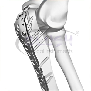 Manual Steel Pelvis Locking Plate Instrument Set High Quality CE Certified for Pelvic Reconstruction By <b>Blush</b> Surgical - Product Image 3