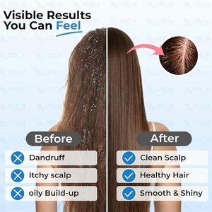 Cepillo para el Cabello, Cuidado del Cuero Cabelludo, Cerdas de Silicona, Redondo, Impermeable, Uso Doméstico, Salón de Belleza, Spa, Cuidado Personal, Otica SH-005 - Product Image 5