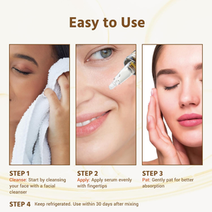 2025 Renéxo Nouveau produit Produits OEM non invasifs Produits de soins de la peau Sérum blanchissant pour le visage de haute qualité - Product Image 3