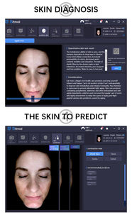 เครื่องวิเคราะห์ผิวแบบพกพา3D สแกนใบหน้า17ตัวบ่งชี้การวิเคราะห์ริ้วรอยผิว8สเปกตรัม - Product Image 6