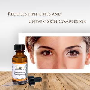 Suero Facial Antiacné Sin Aceite con Ácido Salicílico al 20% y Exfoliante con Ácido de Almendras para Eliminar Granos y Puntos Negros, Renovador de la Piel - Product Image 3
