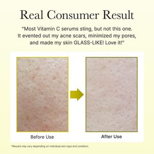 Arencia Vitamin C Booster Shot <b>Face</b> & Eye Cream Moisturizer 30ml Tube for Radiance & Boosting - Product Image 5