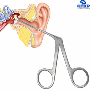 Espéculo Nasal Vienna para Diagnóstico ORL, Juego de 6 Instrumentos, Pinzas Hemostáticas Manuales con Mordazas Serradas, Caja con Cierre, Instrumento Quirúrgico - Product Image 4