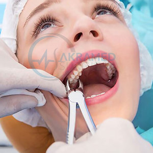 Pinzas de Extracción Dental de Precisión para Cuidado Higiénico Confiable, Pinzas de Extracción Dental de Calidad Confiable - Product Image 5