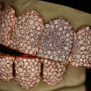 Ensemble de grillz hip-hop de luxe en or rose avec diamants Moissanite, grillz dentaires personnalisés entièrement sertis de Moissanite VVS, bijoux de style rappeur - Product Image 5