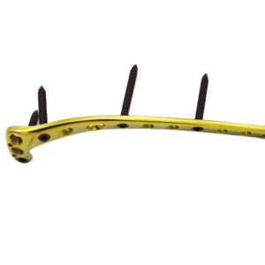 Plaque Tibiale de Verrouillage en Gros 3,5 mm avec Vis de Verrouillage Proximales Manuelles en Acier Inoxydable Certifiées CE ISO13485 pour Usage Hospitalier - Product Image 1