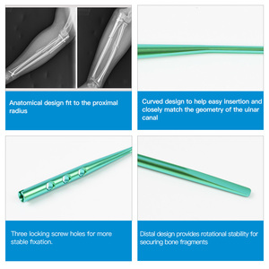 Clou intramédullaire fémoral, système de clouage fémoral proximal pour les fractures intertrochanteriques - Product Image 4