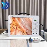 Système de caméra endoscopique médicale portable Ocean 17 pouces Full HD pour laparoscopie, hystéroscopie, chirurgie ORL