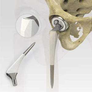 Implante de Reemplazo de Cadera, Cabeza Femoral Artificial y Prótesis de Vástago - Product Image 5