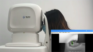 Equipo de Oftalmología, Tomografía de Coherencia Óptica (OCT), Máquina OCT Oftálmica con 3 Años de Garantía - Product Image 4