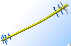 Clavo Intramedular Tibial Suprapatelar de Titanio de Grado Médico de Alto Rendimiento con Construcción Canulada - Product Image 3