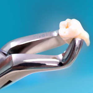 Forceps d'extraction dentaire manuels en acier inoxydable de haute qualité, certifiés CE, avec poignée ergonomique, réutilisables et légers - Product Image 2