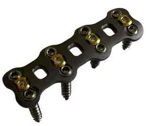 Juego de Instrumentos para Placa Cervical Anterior de Acero Inoxidable Reutilizable, Sistema Ortopédico Quirúrgico de Columna Vertebral por Grip Surgical - Product Image 4