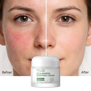 Crème hydratante pour le visage à la centella, à la niacinamide et aux céramides, biologique, personnalisée, en marque privée, pour peaux sensibles - Product Image 4