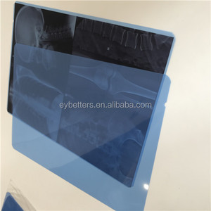 Filme de Raio-X Médico Sob Medida, Desconto para Pedidos em Lote, Ideal para Fornecedores de Equipamentos Médicos - Product Image 6