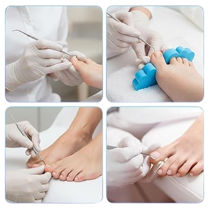 Kit d'outils professionnels de qualité supérieure en acier inoxydable pour ongles incarnés, outil de levage pour manucure et pédicure - Product Image 3