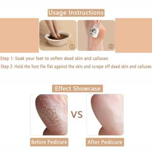Removedor de Callosidades para Pies, Lima para Pies de Acero Inoxidable y Plástico Resistente con Borde Afilado, Raspador Profesional para Piel Dura y Talones Agrietados - Product Image 4