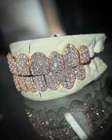 Grillz de Moissanita de Calidad Premium, Hechos a Medida, con Brillo Intenso y Diseño Seguro, Disponibles al Mejor Precio del Mercado