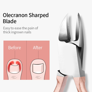 2026 Gold <b>Nail</b> Cuticle Nipper Clipper Cutter Scissor Trimmer Cuticle Dead Skin Remover Pedicure <b>Nail</b> Art <b>Tool</b> - Product Image 3