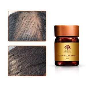 Produits anti-chute de cheveux huile de croissance des cheveux traitement de la perte de cheveux alopécie sérum de croissance au gingembre à base de plantes biologiques - Product Image 6