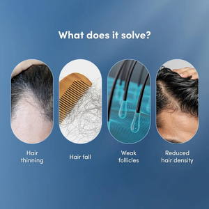 Sets de Cuidado Capilar, Suero Avanzado con Romero en Roll-On para el Tratamiento del Cuero Cabelludo, Promueve el Crecimiento, Previene la Caída del Cabello, Tónico con Extracto - Product Image 6