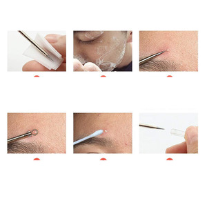 Kit de 7 outils pour éliminer les points noirs et les comédons avec étui en cuir - Product Image 6