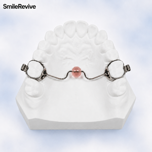 <span class=keywords><strong>Appareil</strong></span> orthodontique personnalisé <span class=keywords><strong>pour</strong></span> la correction des habitudes de succion, <span class=keywords><strong>pour</strong></span> l'arcade supérieure avec bandes molaires, appareils dentaires en gros <span class=keywords><strong>pour</strong></span> les cliniques - Product Image 3