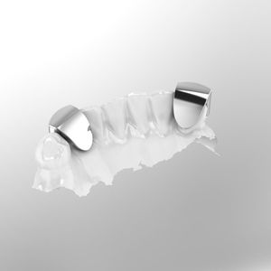 Grillz de Dientes Inferiores Personalizados con Diamantes Cultivados en Laboratorio, Estilo Iced Out, Plata de Ley 925, Joyería Dental Hip Hop, Fabricante ODM - Product Image 6