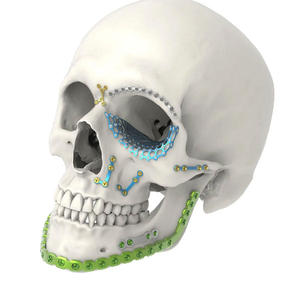 Ensemble d'instruments de chirurgie plastique maxillo-faciale en acier inoxydable, manuel, pour usage hospitalier, par Surgiright Instrument - Product Image 3