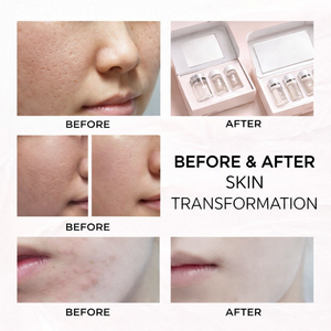 Marca Privada NAG PN HA, Potenciador de la Piel Antiarrugas, Reafirmante, Blanqueador e Hidratante para una Piel Radiante y Elástica - Product Image 4