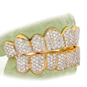 Grillz Hip Hop de Luxe Plaqué Or, Ensemble Complet Sertie de Diamants Ronds, Finition Personnalisée, Bijoux pour Dents - Product Image 3